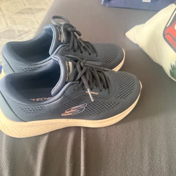 Skechers Ayakkabı Ciddi Tahriş Ve Garanti Sorunu Yaşattı