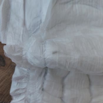 Bebek Bezi İçinde Sert Parça İle Karşılaştım, Güvenlik Endişesi Yaşıyorum