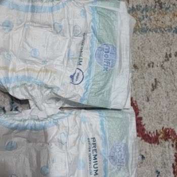 Molfix Bezlerde Kalite Düşüşü Ve Pişik Sorunu Yaşadım