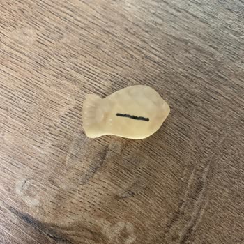 Jelibonun İçinden Yabancı Cisim Çıkması Ve İlgisiz Müşteri Hizmetleri