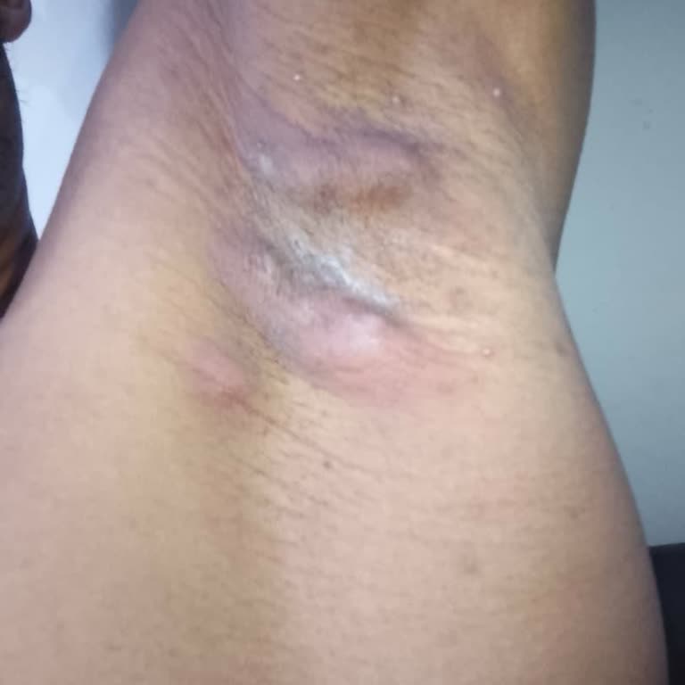 My Awful Rexona Experience