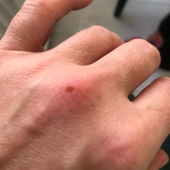 Doğal Olduğu İddia Edilen Temizleyici Ciddi Sağlık Sorunlarına Yol Açtı