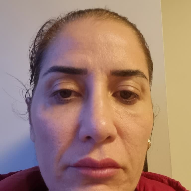 Yetkisiz İşlem Ve Yüksek Ücret Mağduriyeti: İade Talebim Reddedildi