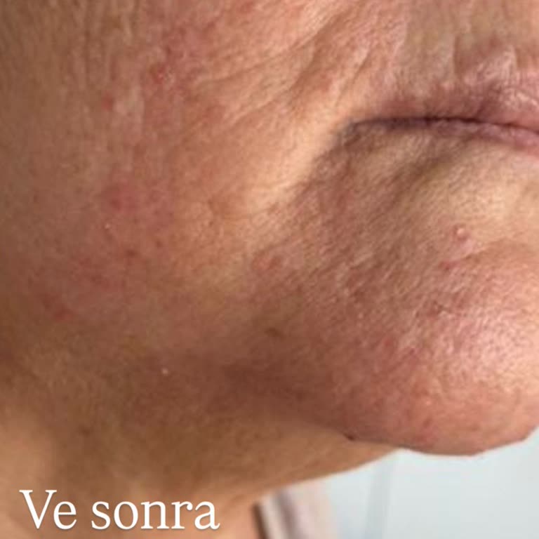 Eva Plus (Eskişehir) Hizmetten Hiç Memnun Kalmadık