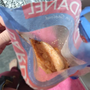 Bozuk Somon Ürünü Hamilelikte Sağlık Riski Yarattı