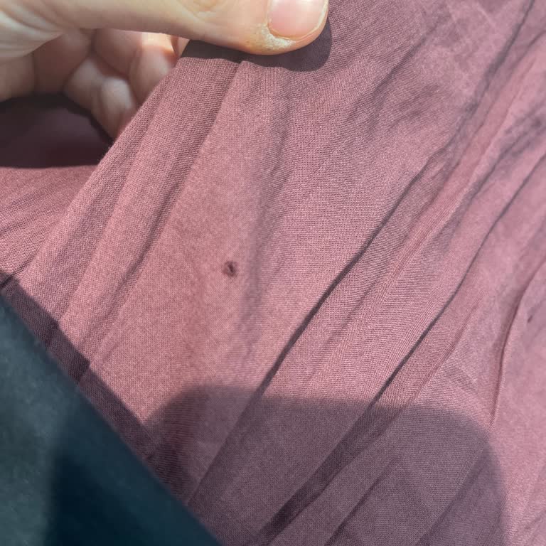 İlk Kullanımda Yırtık Etek Ve Mağaza İlgisizliği