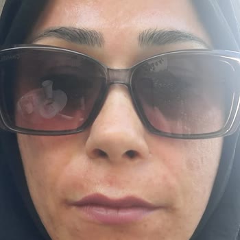 Ameliyat Sonrası İlgisizlik Ve Ek Ücret Talepleri