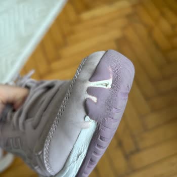 Altı Ayda Deforme Olan Ayakkabıma Çözüm Bulamıyorum