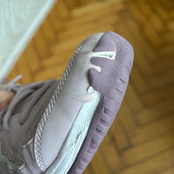 Altı Ayda Deforme Olan Ayakkabıma Çözüm Bulamıyorum