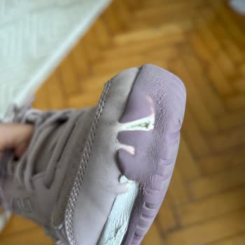 Altı Ayda Deforme Olan Ayakkabıma Çözüm Bulamıyorum