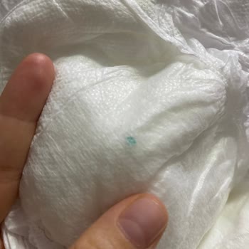 Sleepy Bebek Bezinde Plastik Parçası Şoku: Güven Sarsıldı