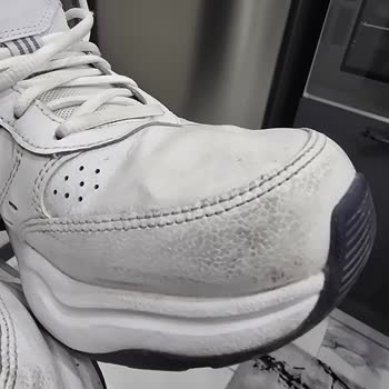 Adidas Strutter Ayakkabıda 1 Haftada Deformasyon Ve Değişim Talebimin Reddedilmesi