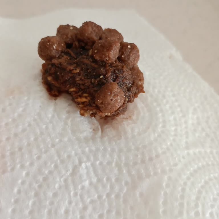 Kahvaltılık Gevrekten Çıkan Sert Yabancı Parça Sağlığımı Riske Attı