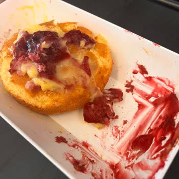 Pegasus Alerjen İçerikli Ürün Nedeniyle Hayati Tehlike Yaşadım