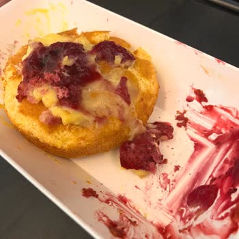 Pegasus Alerjen İçerikli Ürün Nedeniyle Hayati Tehlike Yaşadım