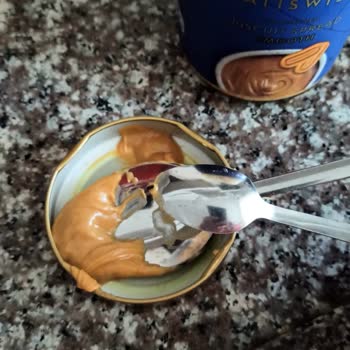 Üründe Yabancı Cisim Ve Müşteri Hizmetleri İletişimsizliği