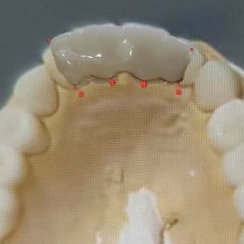 Dental Clinic Tedavi Sonrası Diş Kaybı, İlgisizlik ve Güvenlik Endişesiyle Mağduriyet Yaşadım