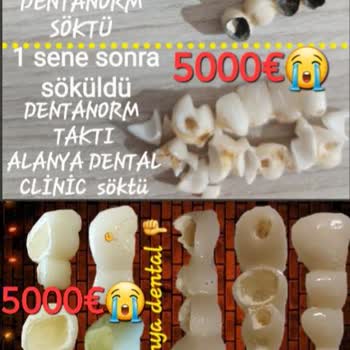Dental Clinic Tedavi Sonrası Diş Kaybı, İlgisizlik ve Güvenlik Endişesiyle Mağduriyet Yaşadım