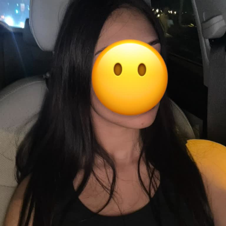 Saç Boyası Beklenenden Farklı Sonuç Verdi, Acil Çözüm Bekliyorum