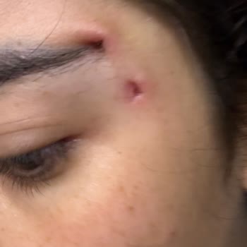 İşlem Sonrası Asimetri, İyileşme Sorunu Ve İletişimsizlik Nedeniyle Mağduriyet