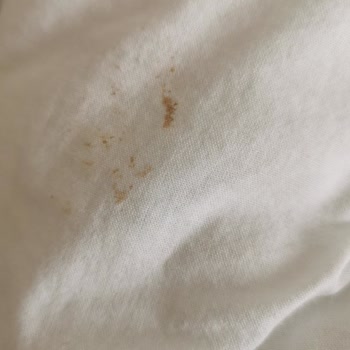 Yıkamadan Sonra Yorganım Lekeli Ve Küflü Teslim Edildi