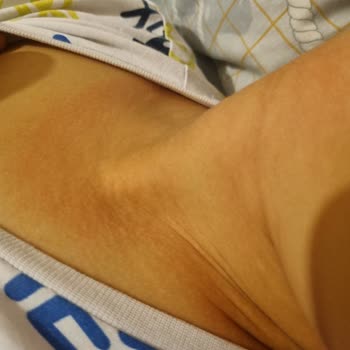 Berko İlaç Çocuğumda İburamin Cold Şurubu Sonrası Şiddetli Alerjik Reaksiyon Gelişti