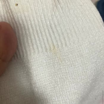 Gardrops'tan Aldığım Kirli Ve Lekeli Kazak İçin İade Ve Destek Sorunu