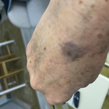 Aldığım Aurafix Bilekliklerde Kalite Sorunu Ve Değişim Talebime Ret