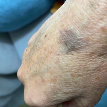 Aldığım Aurafix Bilekliklerde Kalite Sorunu Ve Değişim Talebime Ret