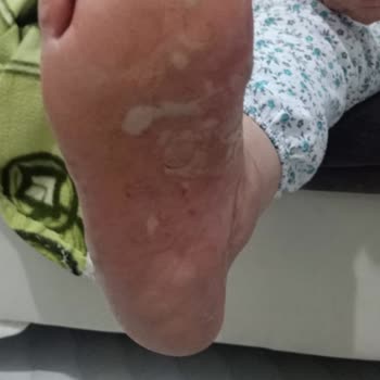 Uyarılara Rağmen Yanlış İlaç Reçetesi Sonrası Annemde Ciddi Sağlık Sorunları Yaşandı