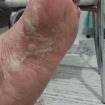 Uyarılara Rağmen Yanlış İlaç Reçetesi Sonrası Annemde Ciddi Sağlık Sorunları Yaşandı