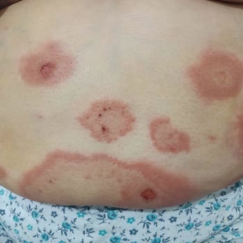 Uyarılara Rağmen Yanlış İlaç Reçetesi Sonrası Annemde Ciddi Sağlık Sorunları Yaşandı