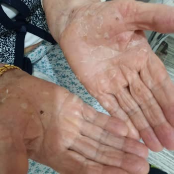 Uyarılara Rağmen Yanlış İlaç Reçetesi Sonrası Annemde Ciddi Sağlık Sorunları Yaşandı