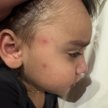 Sinek Sorunu, Yetersiz Temizlik Ve İlgisiz Yönetim Tatilimizi Mahvetti