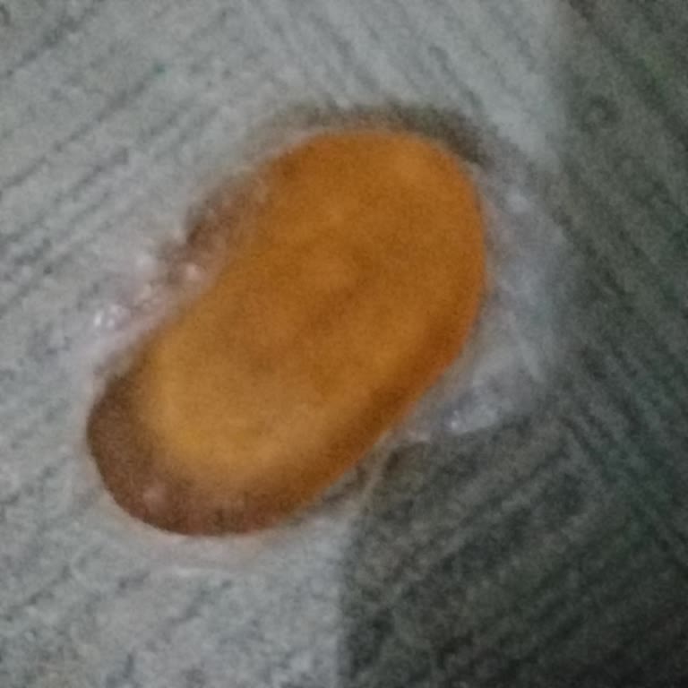 Duru Sakura Sabun Kullanımı Sonrası Ciltte Kaşıntı Ve Pullanma Sorunu