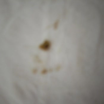 Torku Fıstıklı Çikolatadan Çıkan Kabuk Dişimi Kırıyordu