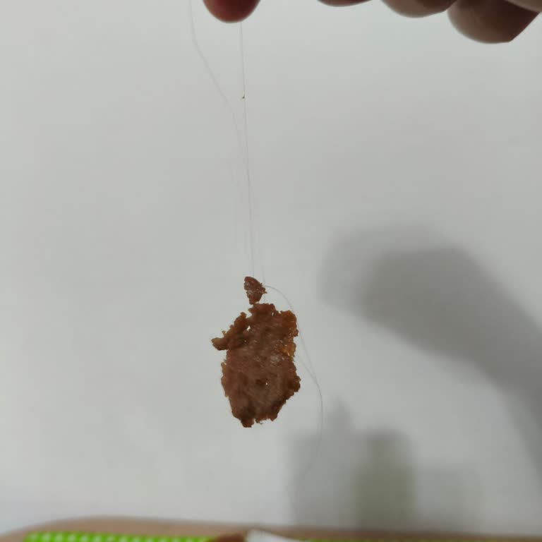 Aldığım Dönerin İçinden Saç Çıktı Hijyen Konusunda Endişeliyim