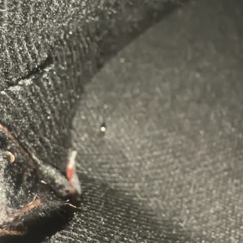 Aldığım Çizmeden Çıkan Çivi Ayağımı Yaraladı İlgisizlik Mağduriyetimi Artırdı