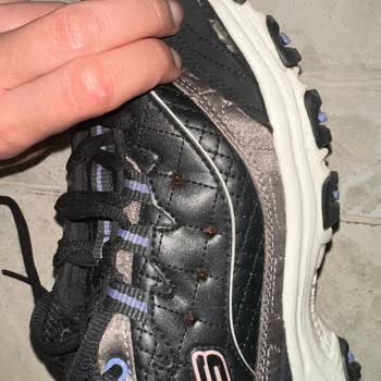 Skechers Mağazasından Alınan Üründe Açılma Ve Değişim Sorunu Yaşadım