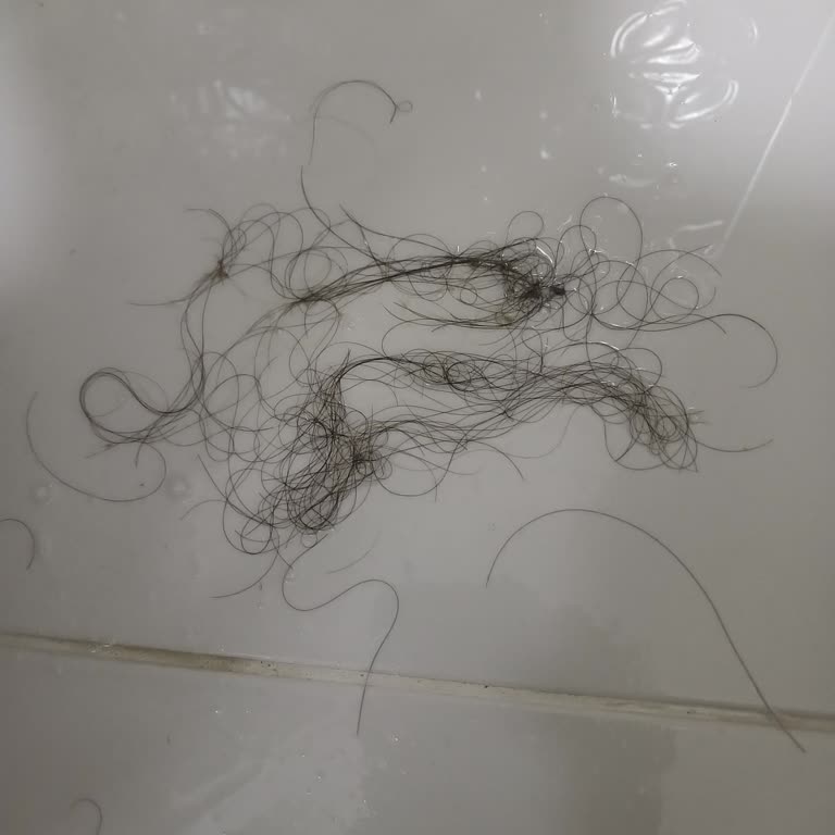 Esse Güzellik Merkezi Saç Dökülmesi Tedavisi İşe Yaramadı Param Boşa Gitti