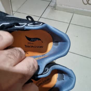 Kısa Sürede Yırtılan Ayakkabı Ve Yetersiz Müşteri Hizmeti