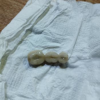 Bergama Ağız ve Diş Sağlığı Merkezi'nde Doktorun İlgisiz ve Agresif Durumu