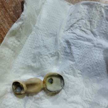 Bergama Ağız ve Diş Sağlığı Merkezi'nde Doktorun İlgisiz ve Agresif Durumu