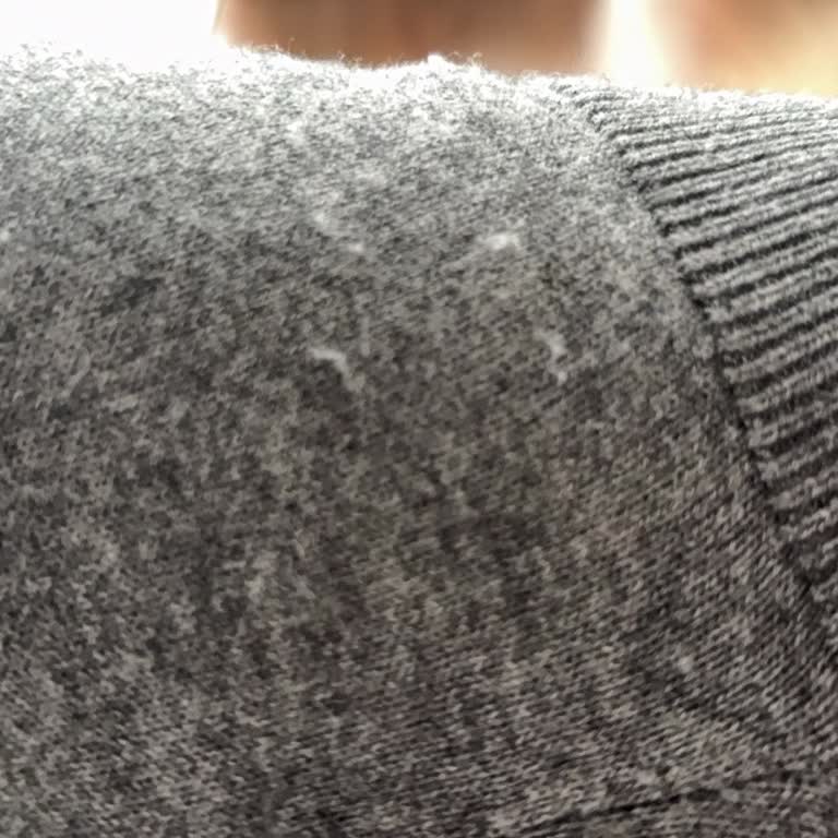 Kısa Sürede Tüylenen Ürünlerin İadesi Kabul Edilmedi, Mağaza Personeli İlgisiz Davrandı