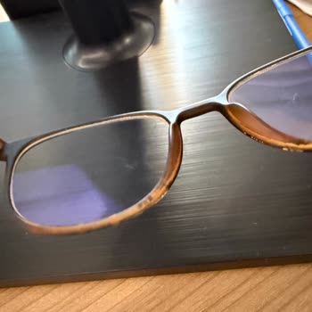 Çizilmeye Dayanıklı Denilen Gözlük Camı Kısa Sürede Çizildi, Destek Alamadım