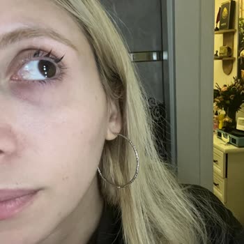 Güzellik Salonunda Hijyen Ve Güvenlik Sorunu Nedeniyle Göz Sağlığım Zarar Gördü