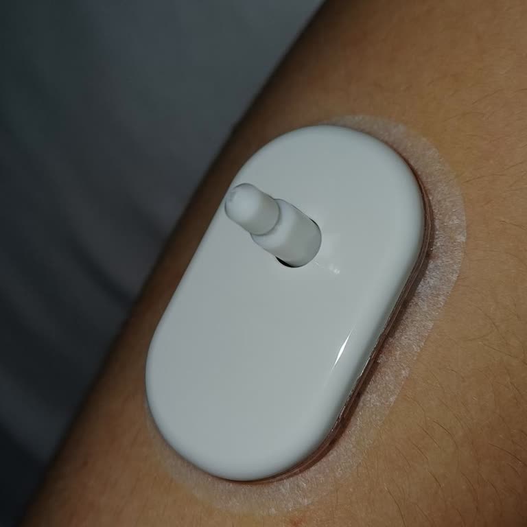 Sibionics GS1 Sensöründe Tekrarlayan İğne Sorunu Ve Garanti Desteği Eksikliği