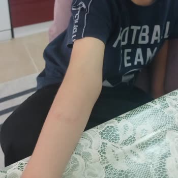 Anaokulu Öğretmeninin İlgisizliği Ve Ayrımcı Davranışları Nedeniyle Çocuğun Olumsuz Etkilenmesi