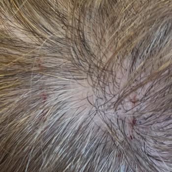 Mağazada Kedi Saldırısı Sonrası Çalışanların İlgisizliği Ve Güvenlik Endişesi