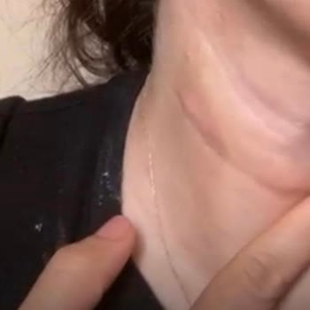 Yanlış Uygulamalar Ve Şüpheli Ürünler Nedeniyle Ciddi Mağduriyet